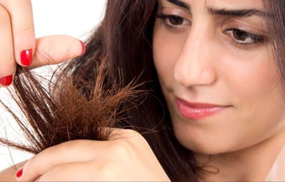 ایا تنها راه درمان موخوره کات کردن مو است ؟